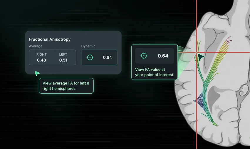 Fractional Anisotropy panel showing average FA for left and right hemispheres alongside a dynamic FA value at the crosshair position, with tooltips explaining each reading.