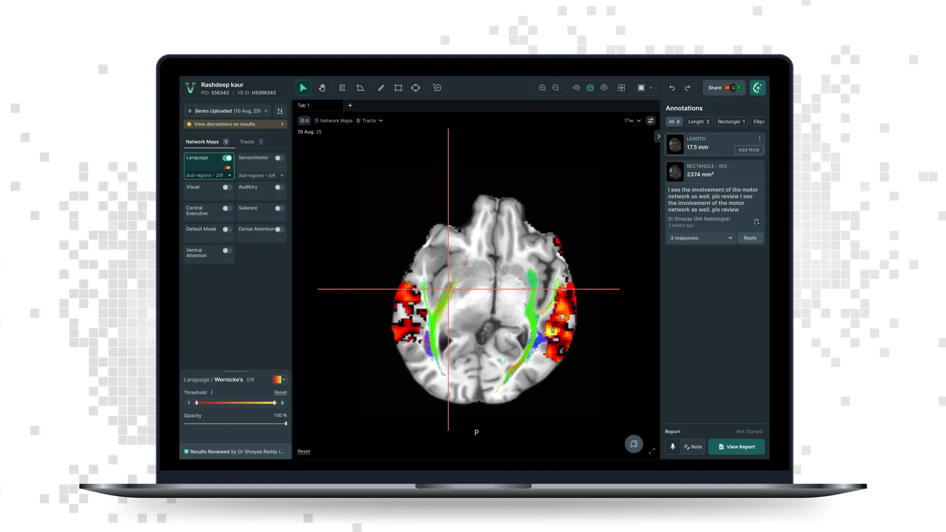 VoxelBox viewer — functional network overlays on structural MRI